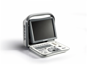 SonoScape A6